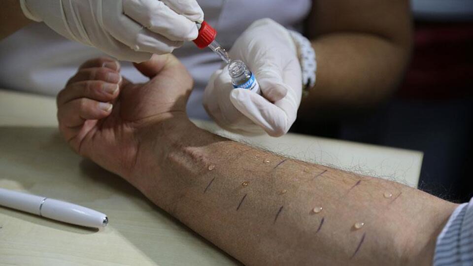 Besin alerjileri ölümcül olabilir!