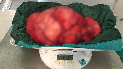 Doktorlar bile hayrete düştü!