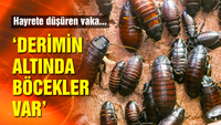 'Derimin altında böcekler var'