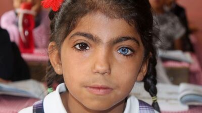 Bir gözü mavi, diğeri siyah! Bakın bu durum resimlerine nasıl yansıyor...