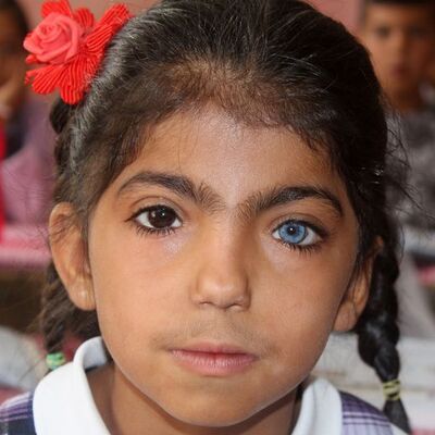 Bir gözü mavi, diğeri siyah! Bakın bu durum resimlerine nasıl yansıyor...