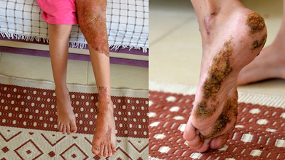 Tıp dünyası, hastalığına çare bulamıyor!