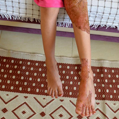 Tıp dünyası, hastalığına çare bulamıyor!