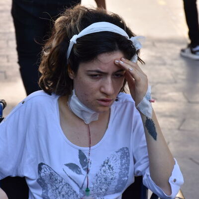 Yaşadığı kabus yüzünden konuşamıyor