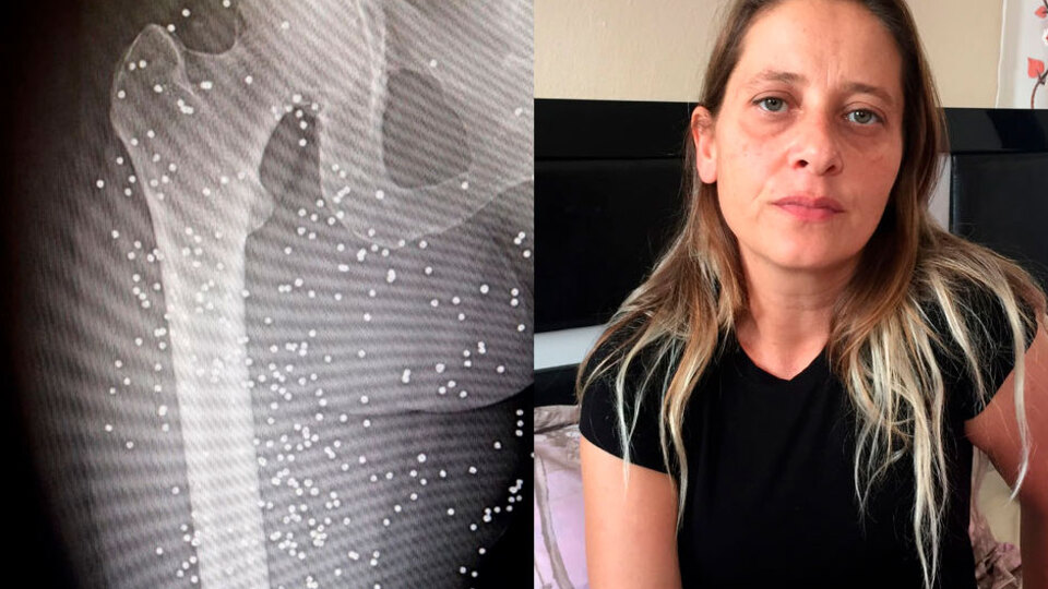 Vücuduna 600 tane saplandı! Böyle yaşamak zorunda