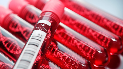 Türkiye'de 10 yıldır araştırılıyordu! Sonunda tespit edildi…