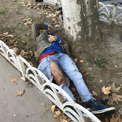 Yaralandı, elbiseleri parçalandı! Ama dünya umurunda olmadı