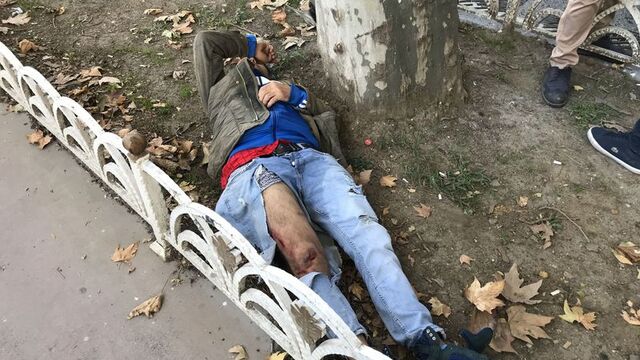 Yaralandı, elbiseleri parçalandı! Ama dünya umurunda olmadı