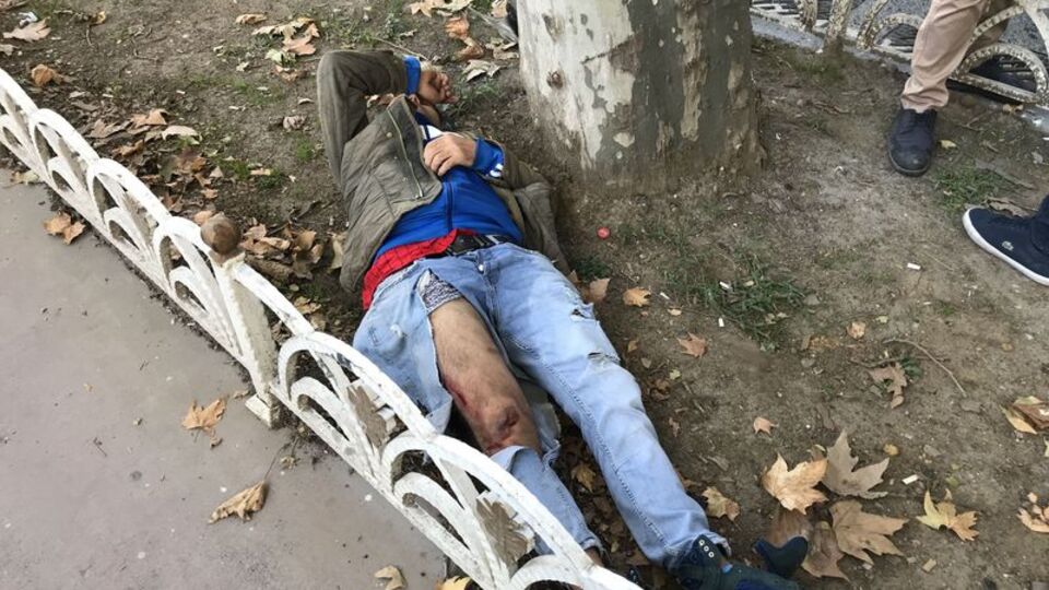 Yaralandı, elbiseleri parçalandı! Ama dünya umurunda olmadı