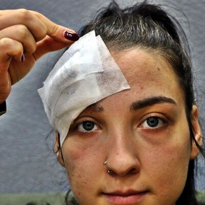 Hastanede skandal olay! Kafasını dikerken unuttular...