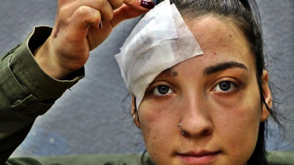 Hastanede skandal olay! Kafasını dikerken unuttular...