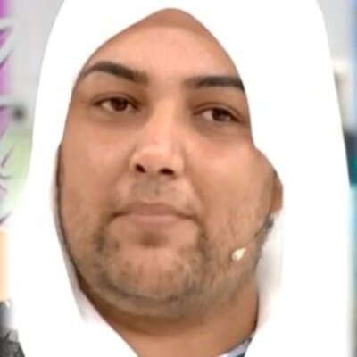 Sakalları hayatını altüst etmişti! İşte mucize değişimi!