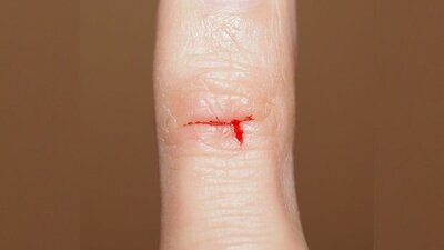 En büyük acılardan biri... Kağıt kesiği neden çok acıtır?