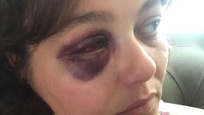 'Havan kime' deyip yumruklamıştı! İşte istenilen ceza...