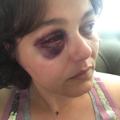 'Havan kime' deyip yumruklamıştı! İşte istenilen ceza...