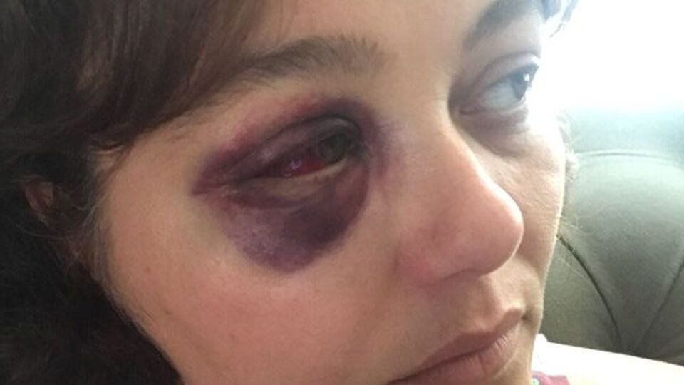 'Havan kime' deyip yumruklamıştı! İşte istenilen ceza...