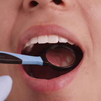 Dikkat! Çürük diş öyle bir şeye zemin hazırlıyormuş ki...