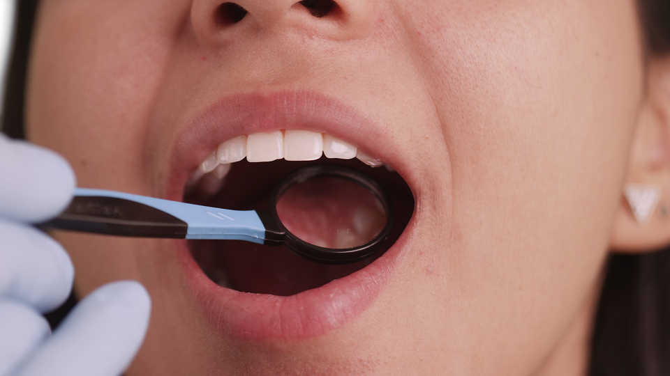 Dikkat! Çürük diş öyle bir şeye zemin hazırlıyormuş ki...