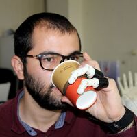 İki parmağı kopunca protez yaptı!