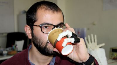 İki parmağı kopunca protez yaptı!