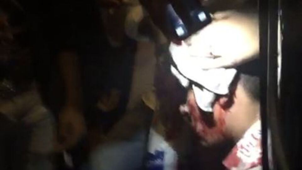 Yol kavgasında otobüs şoförünü levye ile yaraladı!