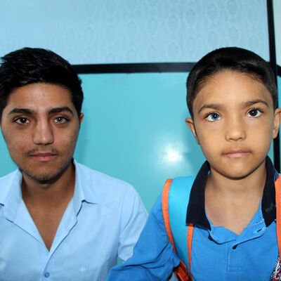 Görenler şaşkın! Bir gözleri mavi, diğeri kahverengi...