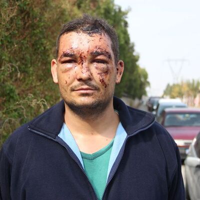 Akılalmaz kaza! Bu araçtan sağ çıktı