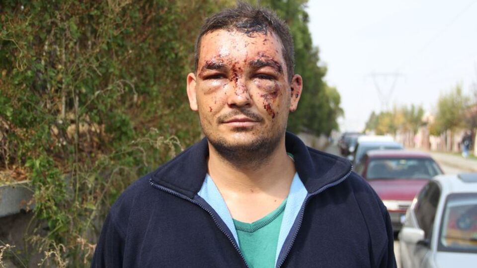 Akılalmaz kaza! Bu araçtan sağ çıktı