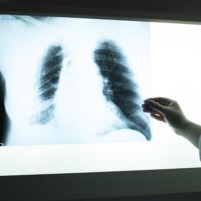 'Hekime giden hasta yanında film taşımayacak'