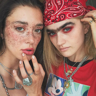 Hastalığı sayesinde ünlü oldu!