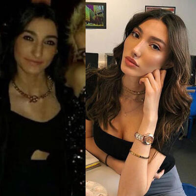 Türkiye güzeli Şevval Şahin'den estetik itirafı