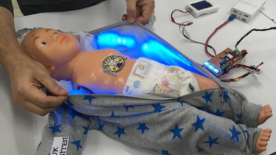 Yenidoğan sarılığına 'tulum'lu takip