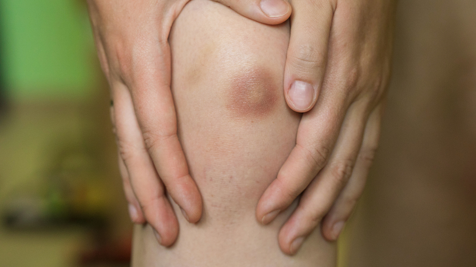 Bu morluğun nasıl olduğunu bilmiyorsanız dikkat!