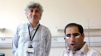 Yüz, çift kol, rahim naklinden sonra...