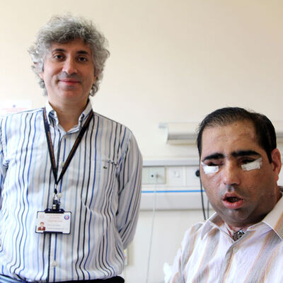 Yüz, çift kol, rahim naklinden sonra...