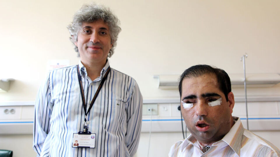 Yüz, çift kol, rahim naklinden sonra...