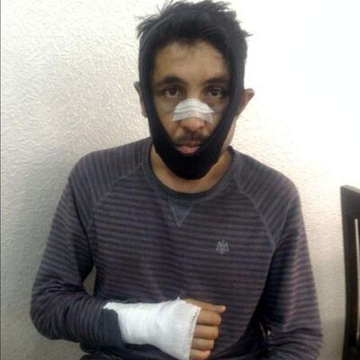 Şüpheliler dışarıda! 'Haraç' verdi darp edildi sığınma evinde!