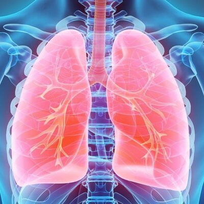 Doktorlar şoke oldu! Kanser teşhisiyle ameliyata alındı ama...