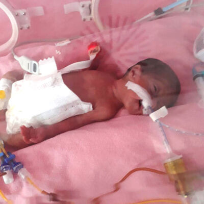 'Parmak bebek' savaşı kazandı!