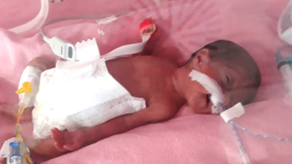 'Parmak bebek' savaşı kazandı!