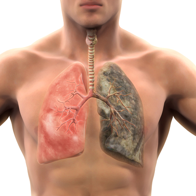 Korkunç! Sigara içmeyen de o risk altında...