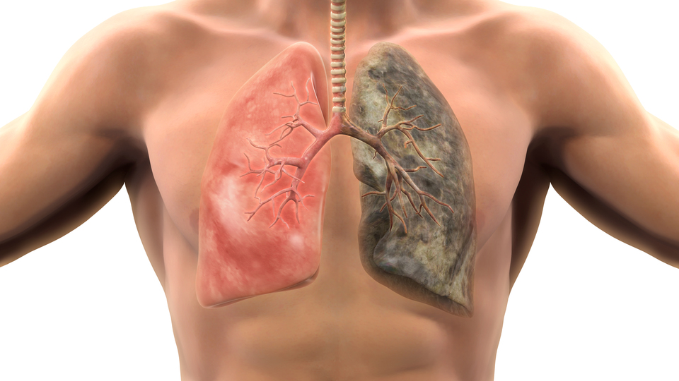 Korkunç! Sigara içmeyen de o risk altında...