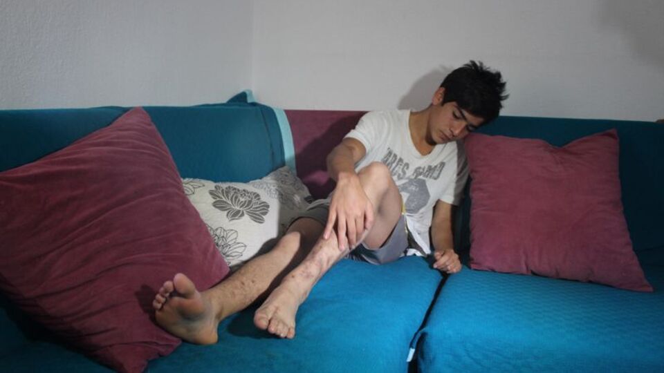 Pitbull dehşetinin izleri silinmedi