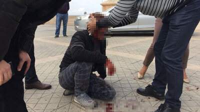 Bir anda ortaya çıktı! Kanlar içinde kaldı