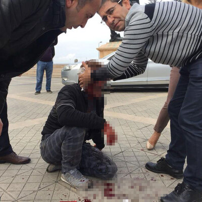 Bir anda ortaya çıktı! Kanlar içinde kaldı