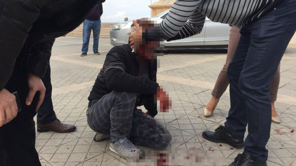 Bir anda ortaya çıktı! Kanlar içinde kaldı