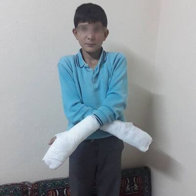 Böyle ceza yok! Okuldan kaçtı diye müdür ellerini kırdı!