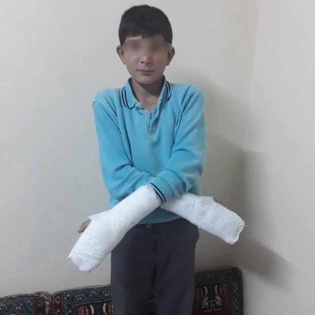 Böyle ceza yok! Okuldan kaçtı diye müdür ellerini kırdı!