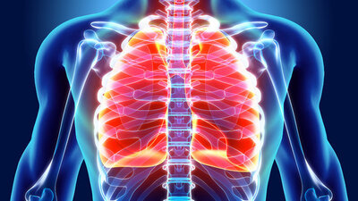 İşte akciğer kanserinin en bilinen sebebi!