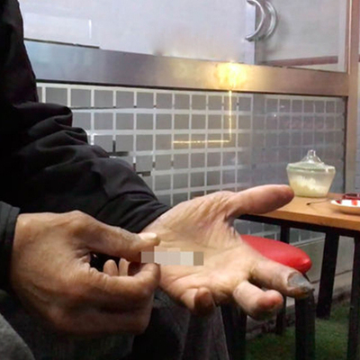 Uzuvlarını kaybetti ama ondan bir türlü vazgeçmedi!